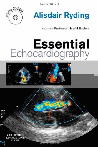 Essential Echocardiography