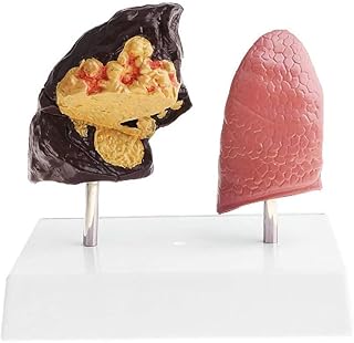Pulmonary Model, 1:1 Life Size Smoking Lung and Normal Lung Comparison Model, Human Breathing System Lung Anatomy Model Medical Lung Anatomy Model Human Organ Models