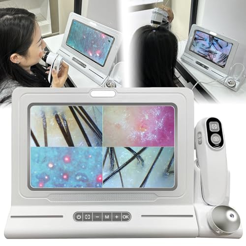 Skin & Scalp Analyzer, 11-Inch HD Portable Skin Diagnosis Hair Analyzer Machine with Dual Zoom (200x/50x), for Hair Salons & Beauty Clinics, Offers 4 Grid Comparison