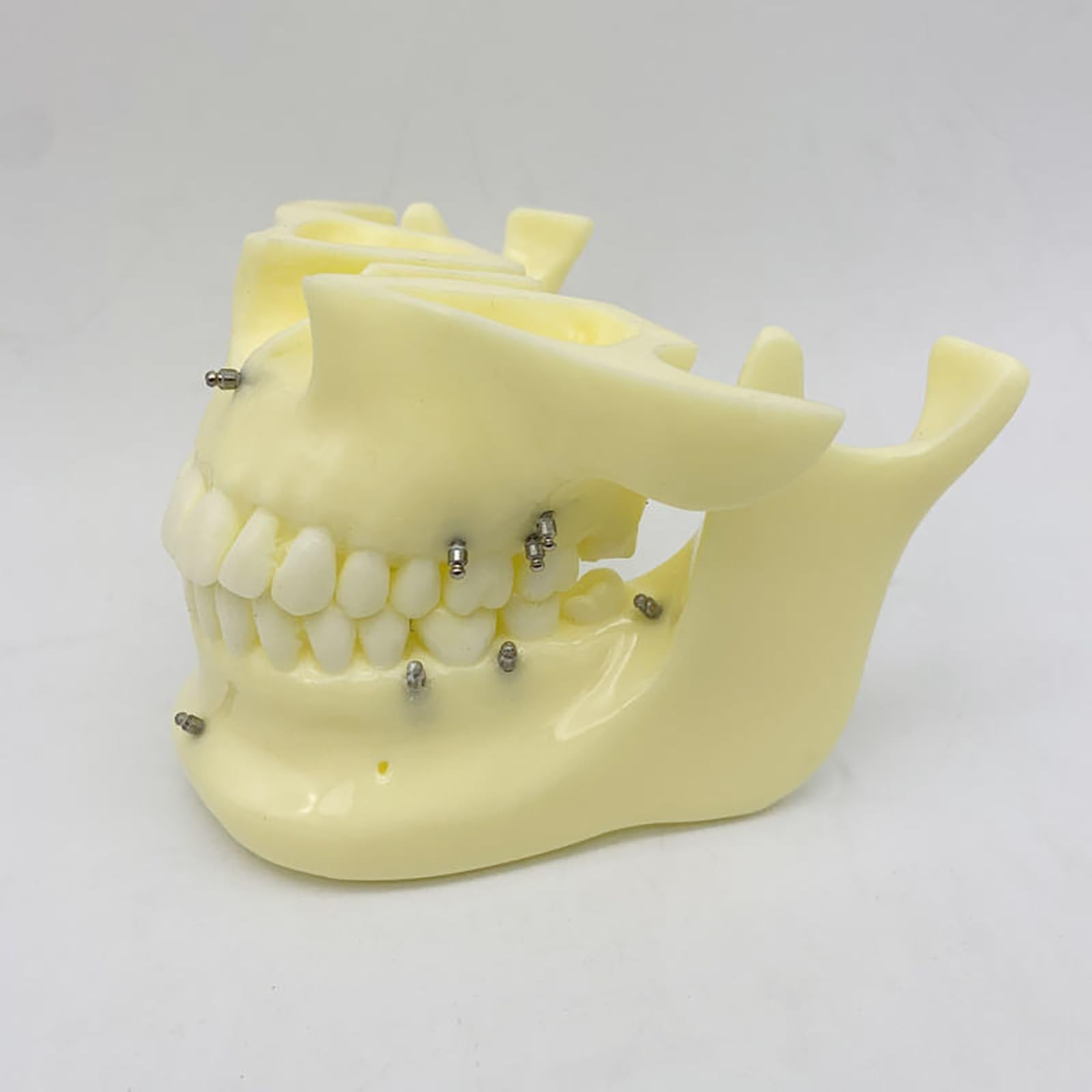 Modello dentale di base per la formazione sull'implantologia, a scopo didattico per studi odontoiatrici e ricerca medica.