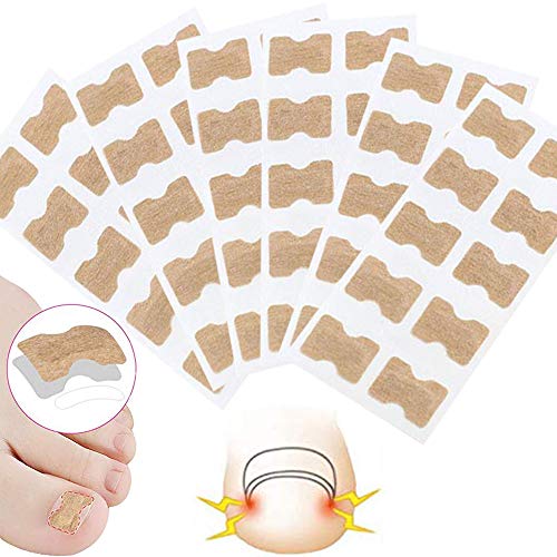 Ingrown Toenails Stickers - 60PCS Glue-free Toenail Patch Painless Pedicure Toenail Correction Sticker Professional Ingrown Toenail Treatment Tool for Women Men