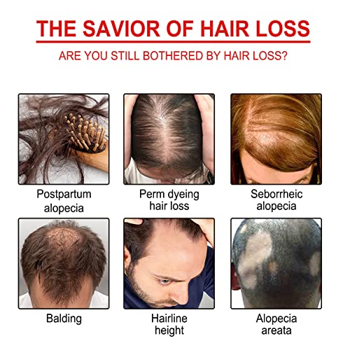 Organic Hair Serum Roller, Regrowth Hair Serum Roller, Triple Roll-On Massager Hair Growth Essence,