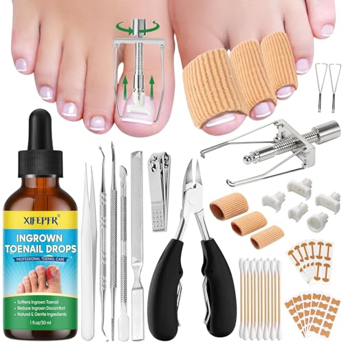 XIFEPFR Kit d'Outils pour Ongle Incarné, Traitement pour Ongle Incarné, Kit de Retrait d'Ongles Incarnés, Correcteur d'Ongle Incarné, Patch Correcteur, Coupe Ongle, Pince Cuticule et Outil de Pédicure