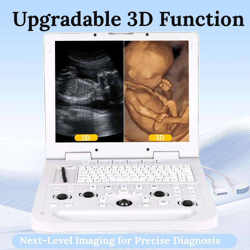 ultrasound machine pro 1669