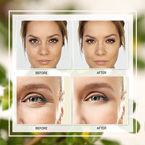 Rapid Reduction Eye Serum, Eye Cream For Dark Circles And Puffiness, Puffy Eyes Treatment, Eye Bags Treatment For Women And Men, Dark Eye Circle Remover, Under Eye Serum, Wrinkle Filler For Deep Wrinkles Instantly, 20 Ml By Ruigeqiji #TOP5