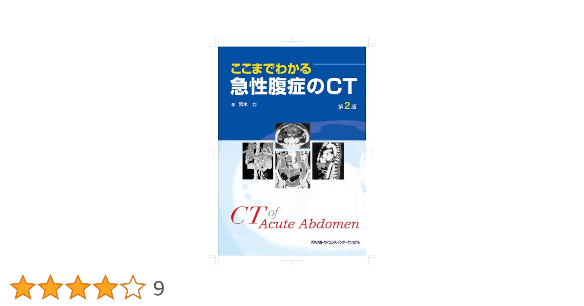 ここまでわかる急性腹症のCT 51MZZJLOE2L._UF350,350_QL50_.jpg