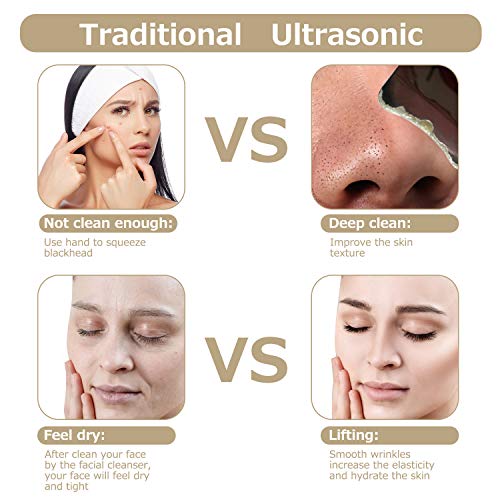 Skin Scrubber, Ultrasonic Pore Cleaner Blackhead Remover, Facial Scrubber Spatula, Comedones Extractor Rechargeable Face Lifting Tool with 3 modes for Facial Deep Cleansing - Thumbnail 3