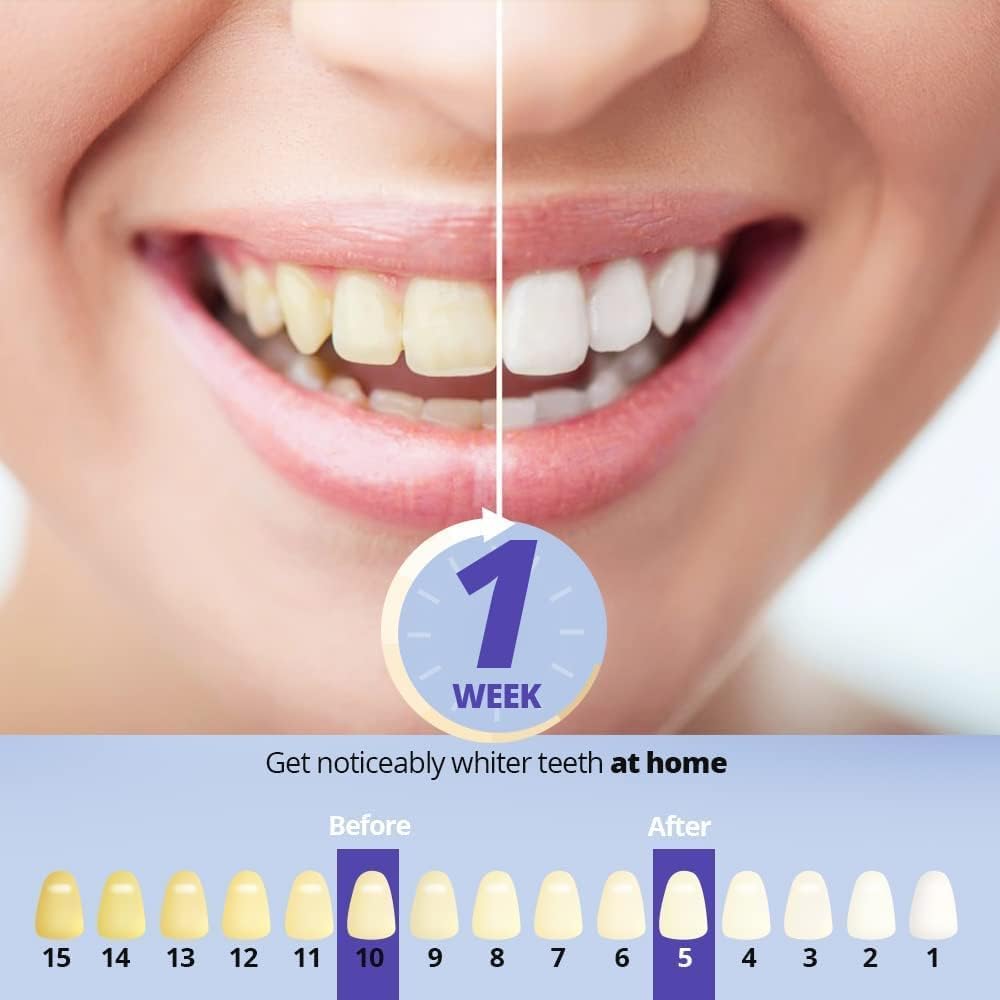 Kit Sbiancamento Dentale, Sbiancamento dei Denti Professionale, 32 x Lampada blu e Rosso, 3 Gel Sbiancante, Gel Lenitivo, Senza Sensibilità, Denti Bianchi a Casa in 10 Minuti