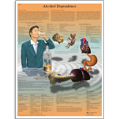 Image of 3B Scientific VR1792UU Glossy Paper Alcohol Dependence Anatomical Chart, Poster Size 20 inch Width x 26 inch Height