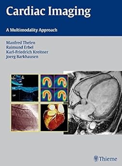 Cardiac Imaging: A Multimodality Approach by Manfred Thelen book cover