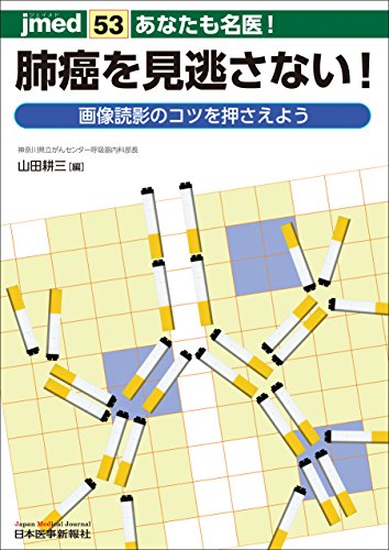無料電子書籍 おすすめ あなたも名医! 肺癌を見逃さない! 画像読影のコツを押さえよう (jmed 53) バイ