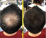 Zoom IMG-1 hairfiberplus 27 5g fibre copri Zoom IMG-1 hairfiberplus 27 5g fibre copri