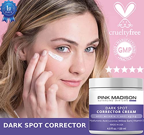 Anti Aging Dark Spot Corrector Cream For Face & Body - Made In Usa - Skin Nourishing Age Spot Remover Women Men 4 Oz #TOP2