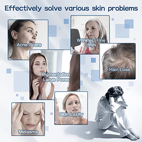Professional Wireless Microneedling Pen With 20 Replacement Cartridges - Adjustable Micro Needling Professional Derma Pen Microneedle Machine,6Pcs 16Pin+6Pcs 36Pin+6Pcs 42Pin+2Pcs Nano-Dark Blue #TOP1