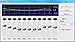 Roxio Easy LP to MP3 | LP and Cassette to CD or MP3 Audio Converter [PC Disc]