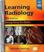 Learning Radiology: Recognizing the Basics [ペーパーバック] Herring MD  FACR，William Amazon | Learning Radiology: Recognizing the Basics, 3e