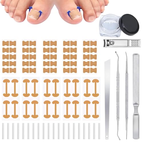 Ingrown Toenail Corrector Set with Breathable Ingrown...