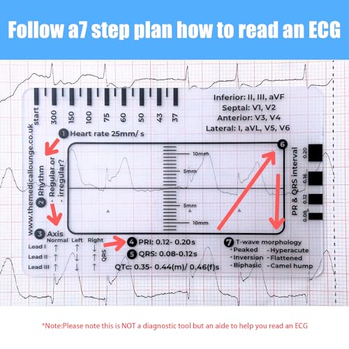Pacote com 2 réguas de ECG 7 etapas ECG 7 etapas para interpretação de ECG ECG Régua de ECG transpar