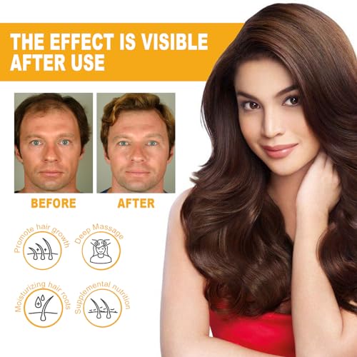 Hair Growth Spray,Hair Growth Serum with Biotin,Fast Growing Hair Care Essential Oils,Anti Hair Loss Serum, Nourishes Hair & Scalp,30ml (1) - Image 3