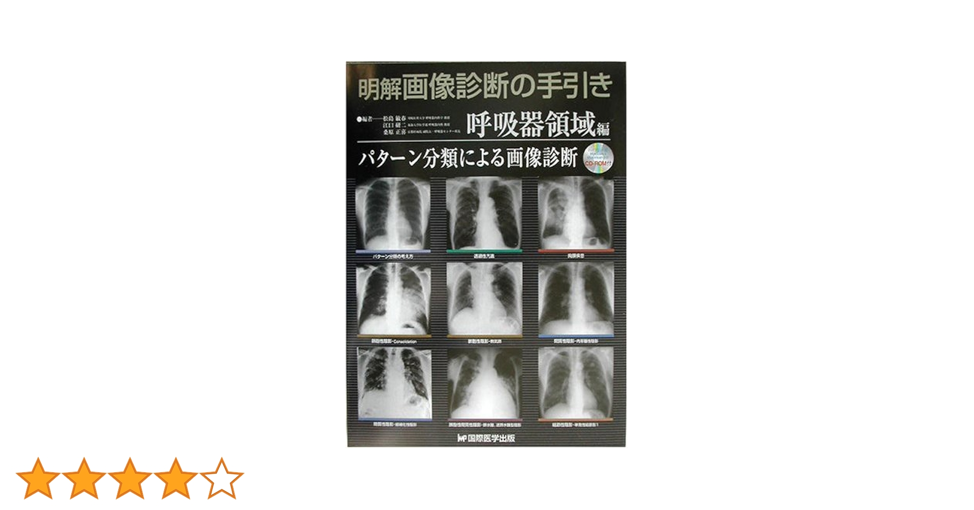 ~臨床・画像・病理を通して理解できる!~呼吸器疾患:Clinical-Radiological-Pathologicalアプローチ 臨床・画像・病理を通して理解できる~呼吸器疾患:Clinical