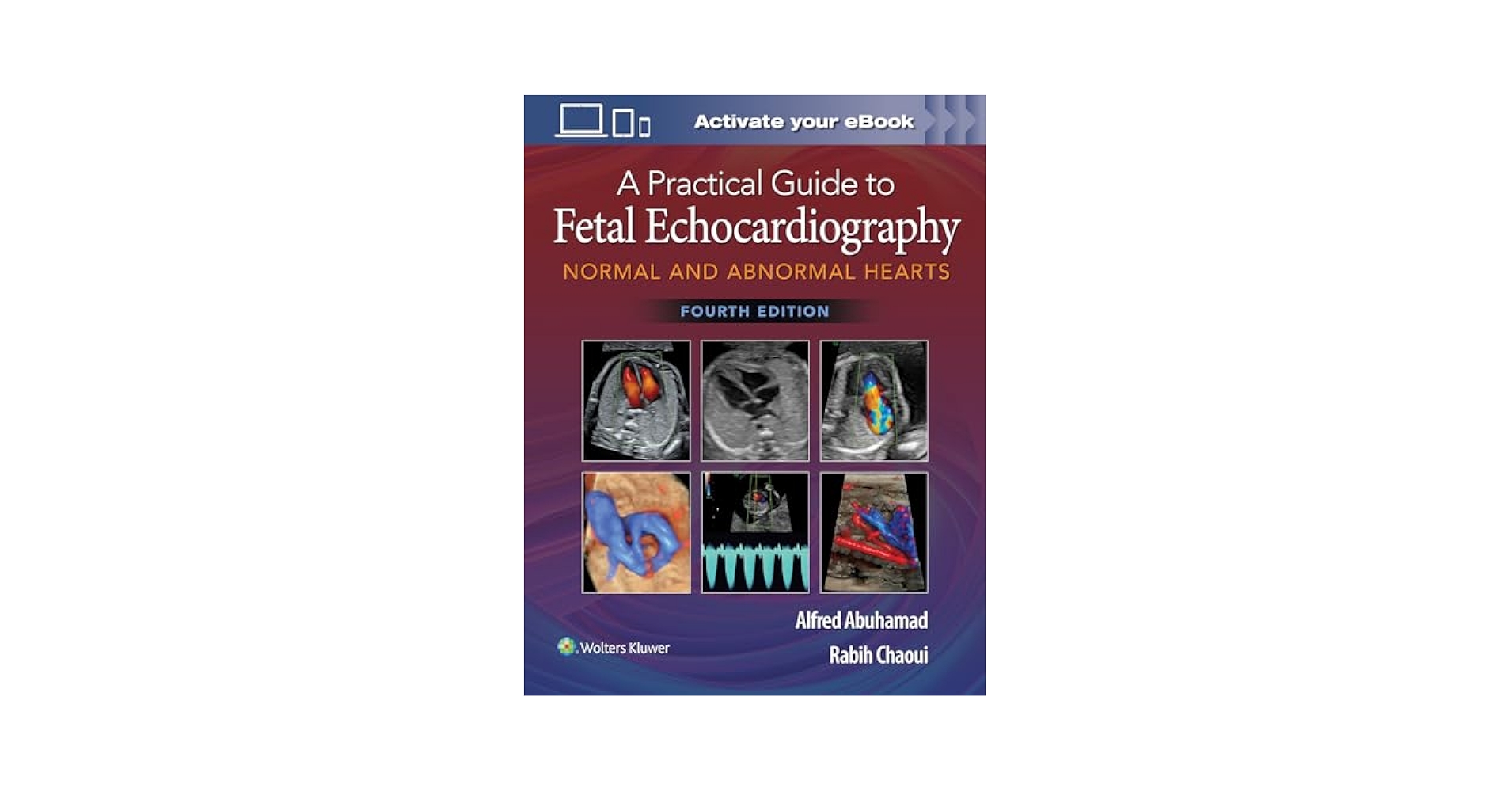 A Practical Guide to Fetal Echocardiography: Normal and