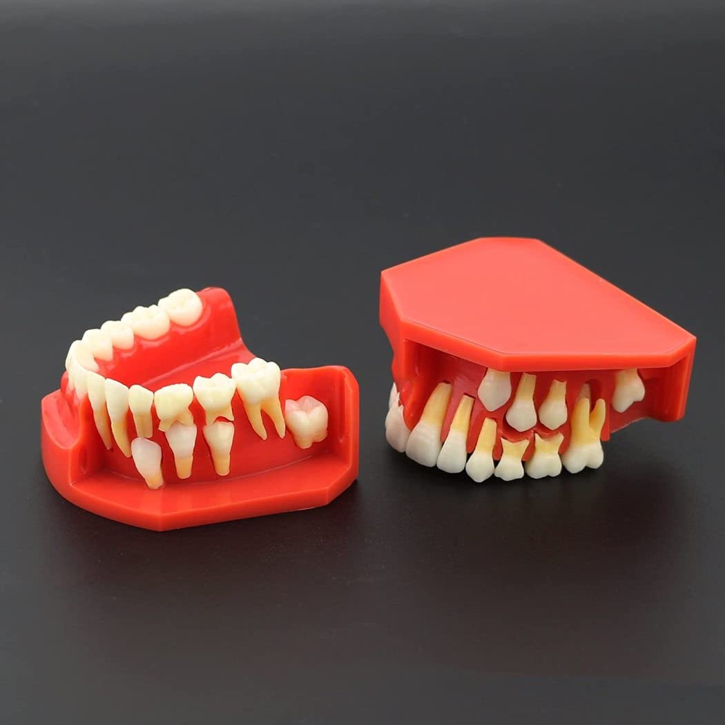 1: 1 Simulación Modelo Dental Modelo De Desarrollo De Erupción De Dientes, Modelo Dental Alterna De La Presentación De Reemplazo De Dientes De Hoja Caduca para Niños para Explicar