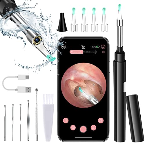 Amazon.co.uk Best Sellers The most popular items in Otoscopes