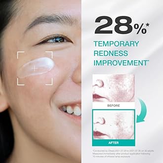 Physiogel Moisturizer Cream, Korean skin care, Soothes Irritation & Redness while Controlling Sebum, Cica, PEA, Niacinamide, Panthenol, Non-Comedogenic, Dermatologist-Tested, Lightweight Cream.