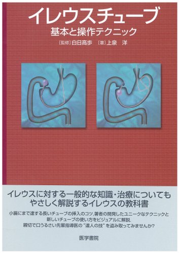 キンドル 無料電子書籍 イレウスチューブ―基本と操作テクニック バイ