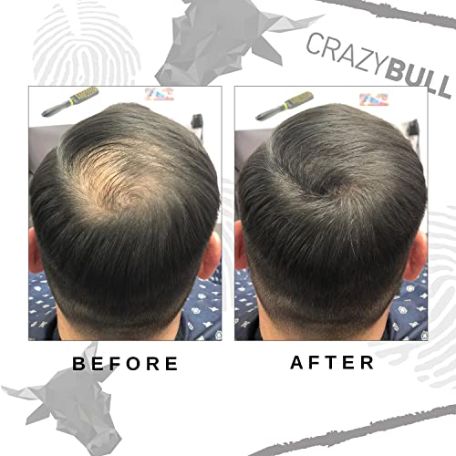 Hair Building Fibre, Long-Lasting, Easy Apply Hair Fibre Concealer for Thinning Hair & Bald Spots - Image 3