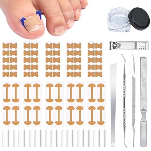 Ingrown Toenail Corrector Set with Correction Strips,...