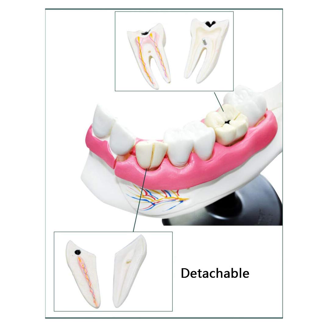Modèle D'Enseignement Des Dents – Modèle Anatomique Des Dents – Modèle D'Enseignement De L'Étude Des Dents Dentaires Et Modèle D'Anatomie Molaire Pour Aide À La Formation Des Étudiants En Médecine