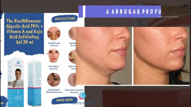 Resultado de imagen de Ojos brillantes: iluminando los beneficios de Aloe Vera para los círculos oscuros infografías