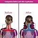 Cervical Neck Traction Device, Hals Zugvorrichtung, Nackenstütze, Nackenbandage für Nackenschmerzen und Unterstützung, für die Entlastung der Halswirbelsäule Druck, Rose Red