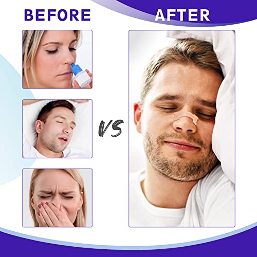 Nasal Strips, 120pcs Nose Strip to Stop Snoring, Less Congestion, Snoring Strips to Help You Breathe Through Your Nose, Anti Snore Nasal Strips for Snoring