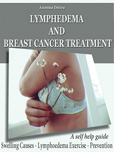 LYMPHEDEMA AND BREAST CANCER TREATMENT: Swelling Causes - Lymphoedema Exercises - Prevention