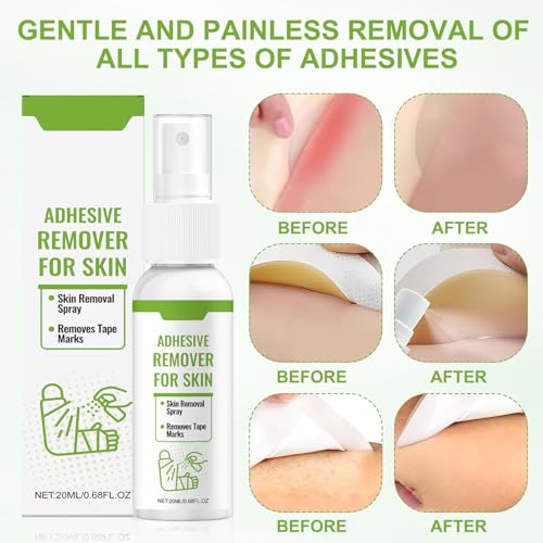Pflasterentferner Spray Klebereste Entferner Pflasterspray Wird zum Entfernen von Klebstoffen wie Verbänden Latex Gaze usw Verwendet(40ml)