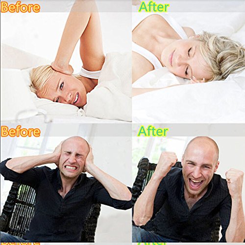 Paradenti ortodontico, Cheyenne Night paradenti