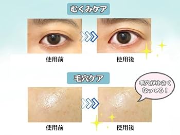 goochie cool spot sense/痛み止め/冷却装置/毛穴引き締め goochie cool spot sense/痛み止め/冷却装置/毛穴引き締め