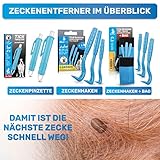 BluePet 2X Automatische Zeckenzange als Zuverlässige Zeckenpinzette Für Hunde, Katzen, Pferde & Menschen I Perfekter zeckenentferner für jedes Zeckennotfallset