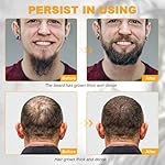 Beard Growth Kit - Beard Kit for Men, Beard Growth Oil (2oz), Beard Balm, Beard Comb, Massager for Spot/Patchy Beard - Christmas, Anniversary, Birthday Gifts for Men, Dad, Husband, Boyfriend - Image 4