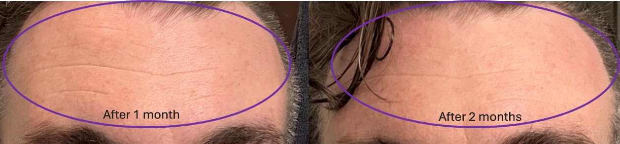 BloomRadiance - Fresh Smoothing Probiotic Lotion for Smoother Looking Skin