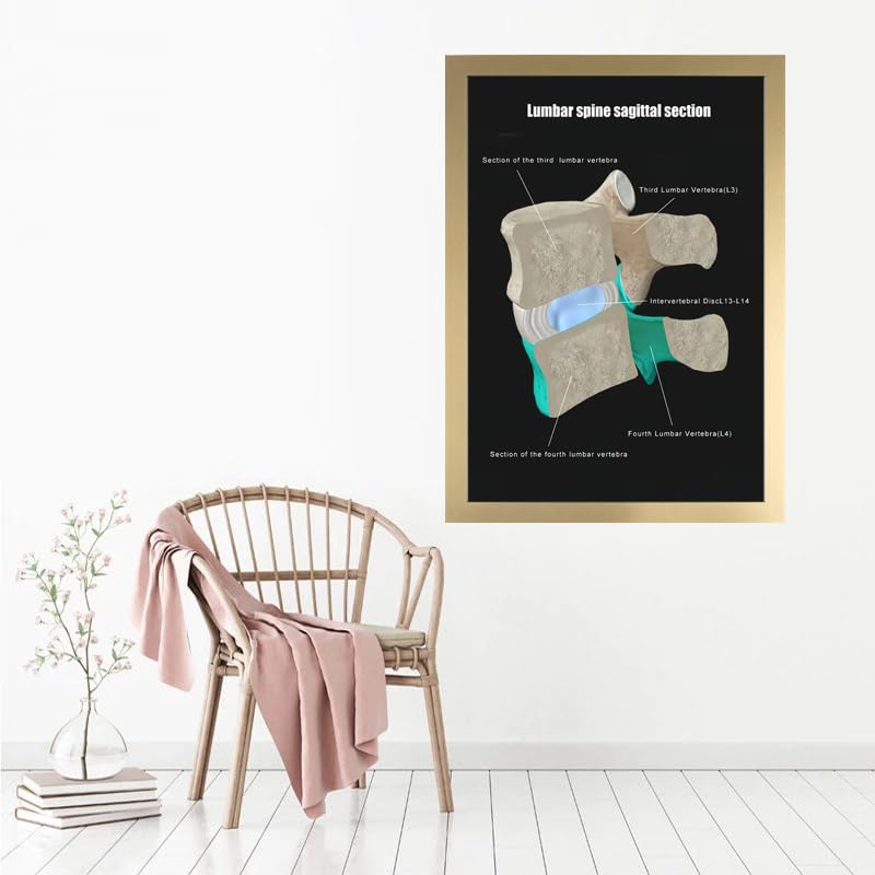 Image of Taanfu Body Educational Learning Anatomy Posters ，Lumbar Plane Art Lumbar Villi Anatomy Art Poster Digestive System Organs Illustration Small Intestine Physiology Anatomy Wall Art Villi