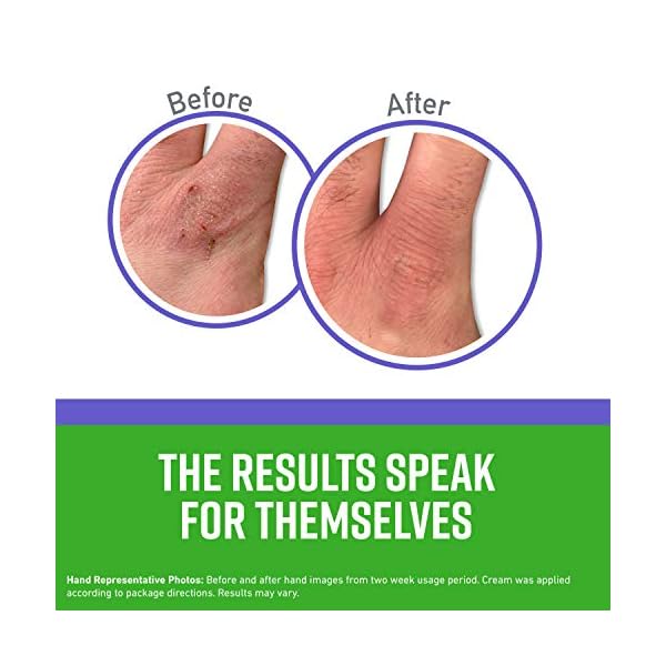 OKeeffes-102965-Night-Treatment-Hand-Cream-2-Pack-White-2-Count O'Keeffe's Working Hands Night Treatment Hand Cream; 3 oz Tube; (Pack of 2)