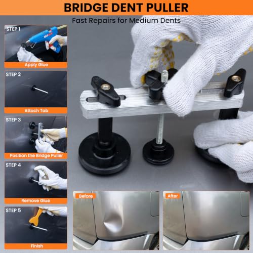 Image of 158pcs Car Dent Puller Kit, Paintless Dent Repair Kit with Golden Lifter, Dent Remover Tool for Car Dents, Hail Damage, Door Ding Repair