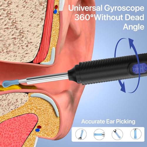 Image of Dr Vaku Clenzio Earocam Ear Cleaner Earwax Removal Tool with Extra Cleaning Kit (Set of 7) HD Camera Wifi Connection & 6 LED Lights Endoscope Tool + 11 Silicone Tips Free & Storage Case-Black /Blue