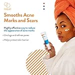 AcneFree Retinol Blemish Mark Resurfacing Serum with Hyaluronic Acid, and Niacinamide | Helps to Reduce the Appearance of Acne Marks | Redness Control | 1 Ounce - Image 2
