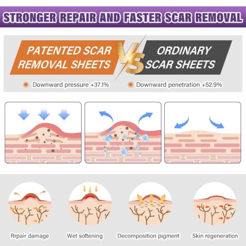 Image of Silicone Scar Sheets, Medical Grade Silicone Scar Tape for Surgical, Hypertrophic, Keloid, C-Section, Burn, Old & New Scars, Reusable Professional Scars Removal Sheets (1.6 inchX 120 inch Roll-3M)