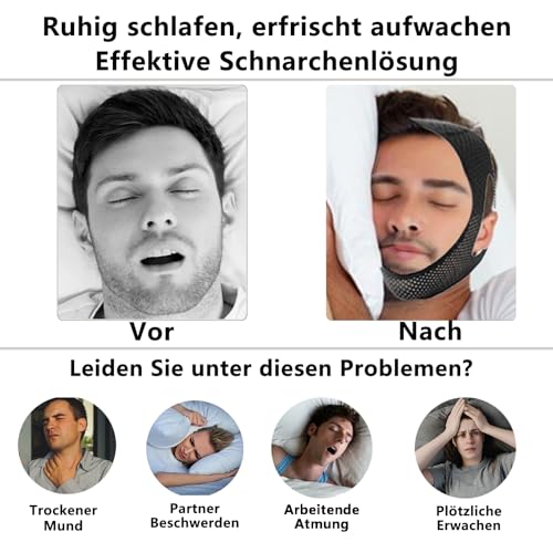 DOHUG Anti Schnarchen Kinnriemen, Schnarchstopper Anti Schnarchen, Kinnband Schlafapnoe, Stop Schnarch-Lösung, Hilfsmittel Gegen Schnarchgerät