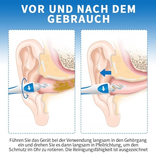 Ohrenschmalz Entferner,Q Grips Ohrenreiniger,Sicheres und Weiches 360 Grad Spirale Silikon Ear Cleaning Kit Mit 16 Sicheres Ersatzköpfen,Verbesserte Version für Erwachsene und Kinder